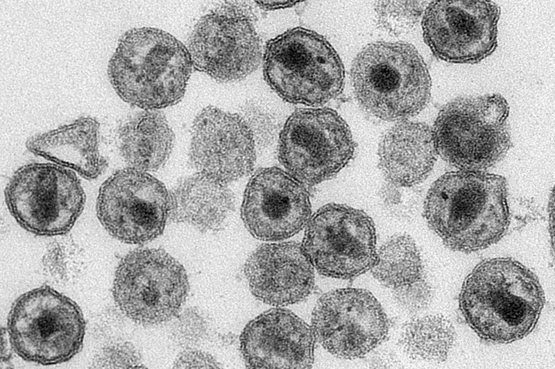 Ubigene HIV Virions